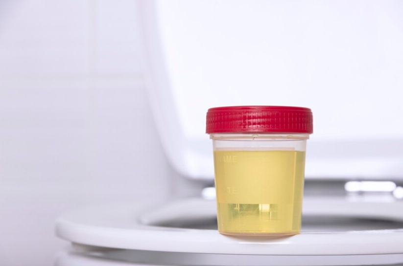 How to Pass Drug Test with Synthetic Urine